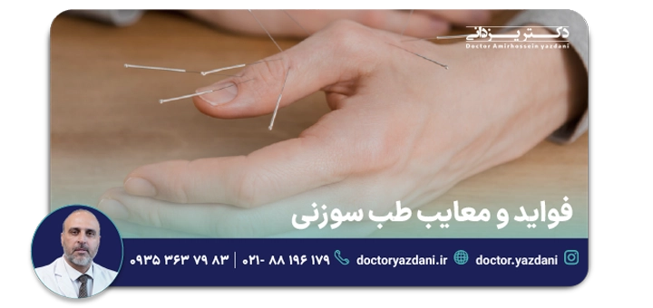 فواید و معایب طب سوزنی
